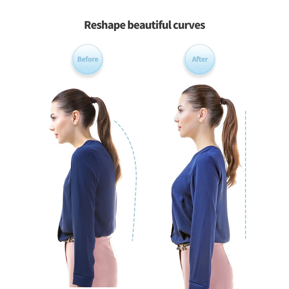 AlignWell™ Smart Posture Trainer (Vibration Reminder Device)